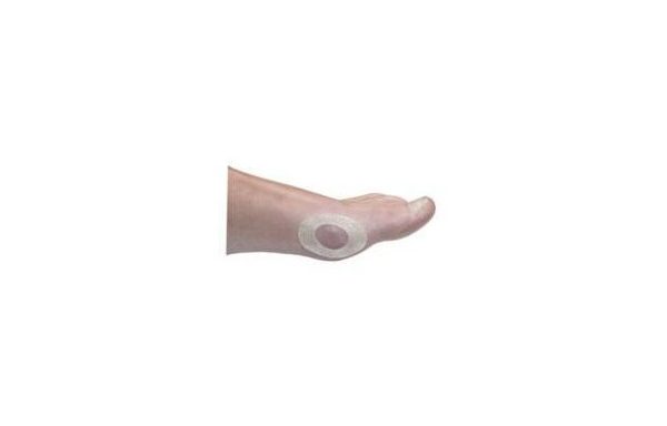 Deramed Oval Adhesive Patch