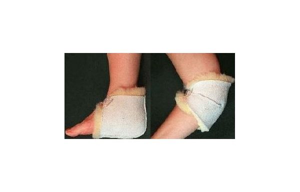 Sheepskin Heel and Elbow Protectors